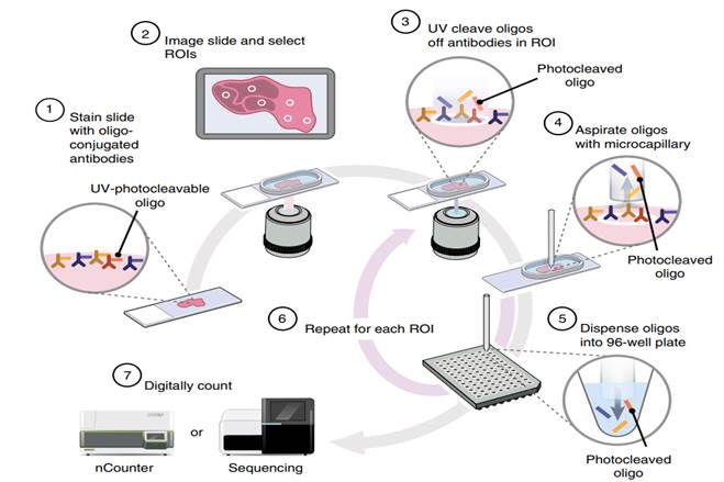 NanoString DSP分析步驟：1. 組織染色； 2. 拍攝影像、圈選ROI；3. UV切割 ；4.5. 收集寡  核苷酸；6. 重複步驟3-5以繼續收集其他ROI；7. NGS定序及DSP軟體分析。